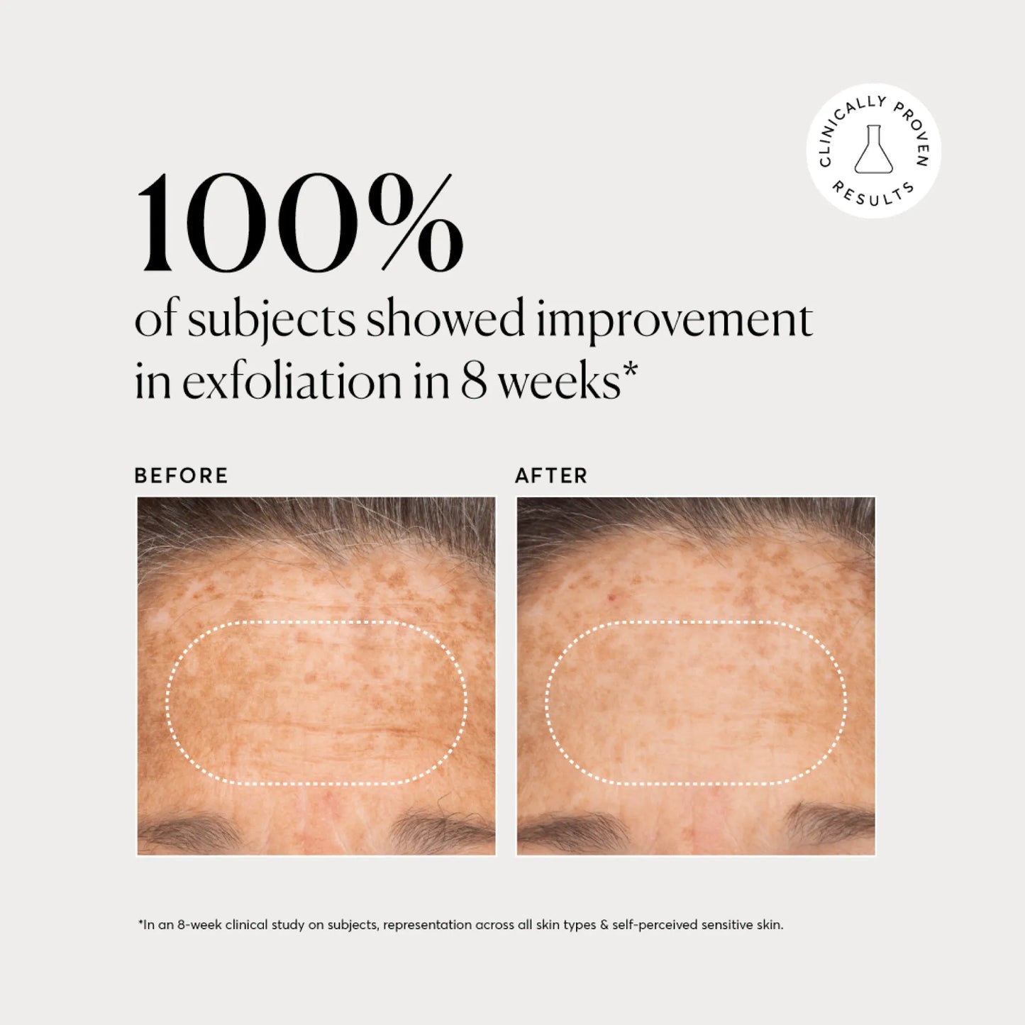 bha-liquid-exfoliant-2-v6 NATR-10027-Alt-Images-BHA-Liquid-Exfoliant-2_-03.webp